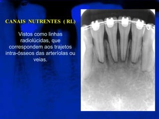 CANAIS  NUTRENTES  ( RL)<br />Vistos como linhas radiolúcidas, que correspondem aos trajetos intra-ósseos das arteríolas o...
