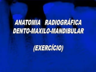 ANATOMIA   RADIOGRÁFICA<br />DENTO-MAXILO-MANDIBULAR<br />(EXERCÍCIO)<br />