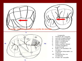 As setas vermelhas indicam a ponte de esmalte
 