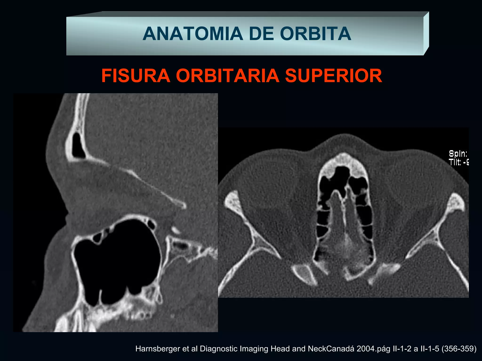Anatomía de Orbita | PPT