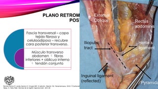 PLANO RETROMUSCULAR – PARED
POSTERIOR
Fascia transversal – capa
tejido fibroso y
celuloadiposo – recubre
cara posterior transverso.
Músculo transverso
abdomen  fibras
inferiores + oblicuo interno
 tendón conjunto
Parrilla Paricio P, Landa García JI. Cirugía AEC 2ᵃ edición. Madrid: Ed. Panamericana. 2010. F.Carbonell
Tatay. X. Feliu Palá. Hernias de la región inguinocrural: 203-18.
 