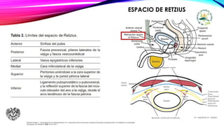 Ramírez-Giraldo, C.; Luque-Bernal, R. M.; Buitrago-Rincón, M. C. Importancia Del Conocimiento anatómico Del Espacio Extraperitoneal Y Su Utilidad En Los Abordajes
Quirúrgicos. Rev Colomb Cir 2023, 38, 521-532.
ESPACIO DE RETZIUS
 