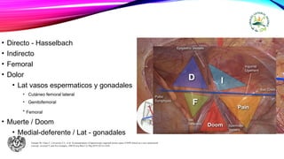 • Directo - Hasselbach
• Indirecto
• Femoral
• Dolor
• Lat vasos espermaticos y gonadales
• Cutáneo femoral lateral
• Genitofemoral
• Femoral
• Muerte / Doom
• Medial-deferente / Lat - gonadales
Furtado M, Claus C, Cavazzola T L, et al. Systematization of laparoscopic inguinal hernia repair (TAPP) based on a new anatomical
concept: inverted Y and five triangles. ABCD Arq Bras Cir Dig.2019;32(1):e1426.
 