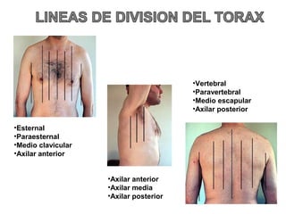 •Esternal
•Paraesternal
•Medio clavicular
•Axilar anterior
•Vertebral
•Paravertebral
•Medio escapular
•Axilar posterior
•Axilar anterior
•Axilar media
•Axilar posterior
 