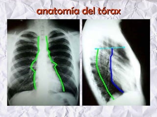 anatomía del tóraxanatomía del tórax
 