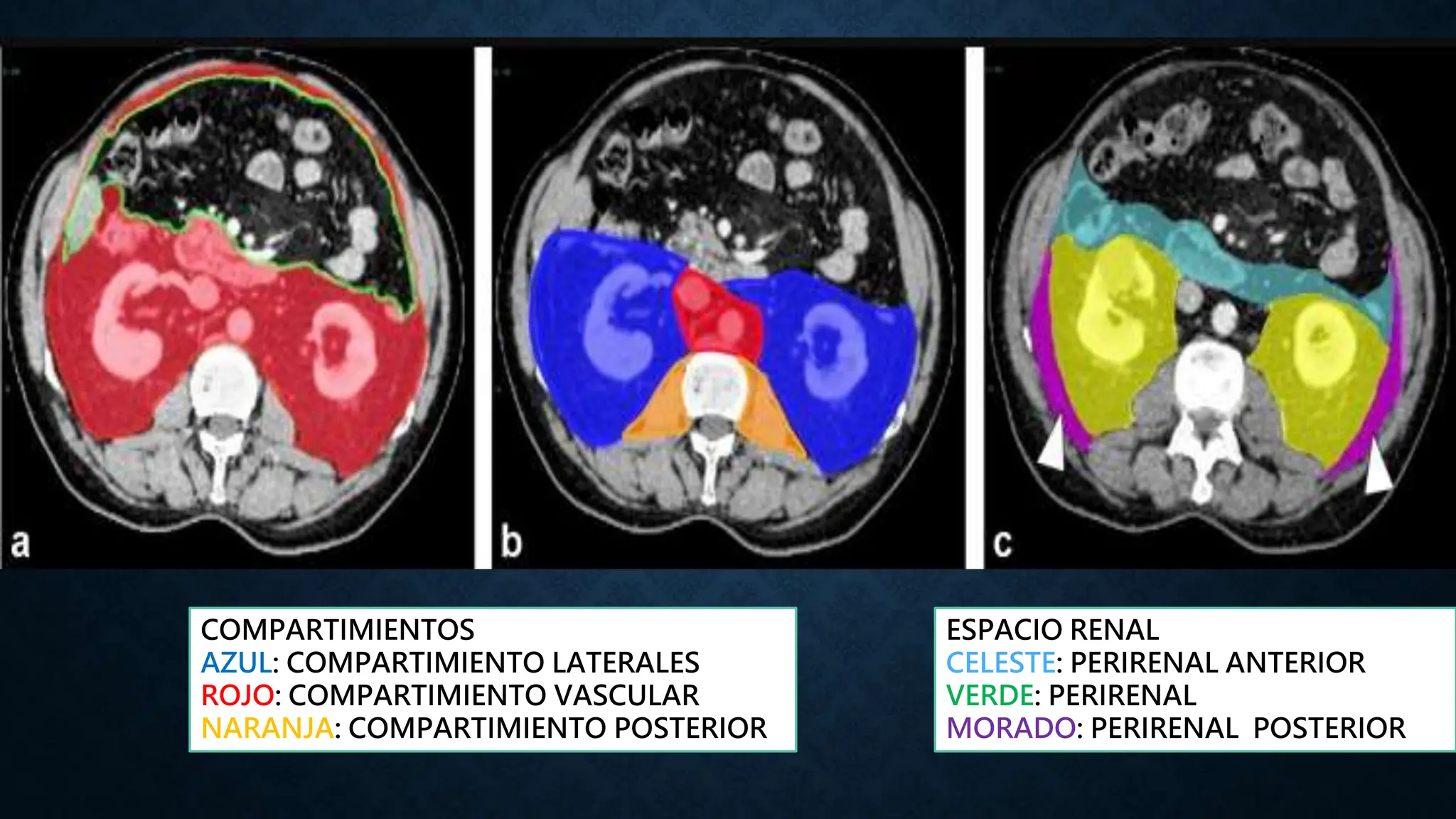 ANATOMIA DE RETROPERITONEO GASTROENTEROLOGIA | PPTX
