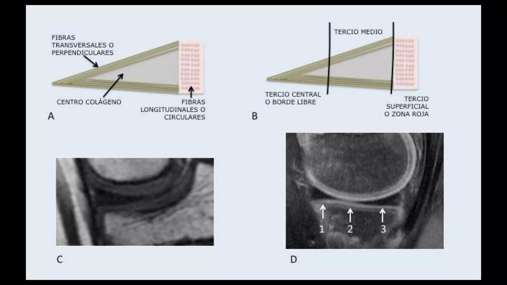 Anatomía de rodilla por resonancia magnética.ppt