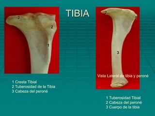 TIBIA
Vista Lateral de tibia y peroné
1
2
3
1 Tuberosidad Tibial
2 Cabeza del peroné
3 Cuerpo de la tibia
1
2
3
1 Cresta Tibial
2 Tuberosidad de la Tibia
3 Cabeza del peroné
 