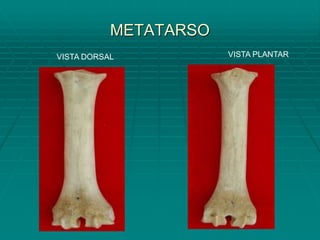 METATARSO
VISTA DORSAL VISTA PLANTAR
 