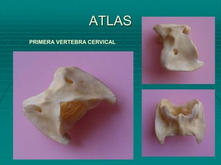 ATLAS
PRIMERA VERTEBRA CERVICAL
 