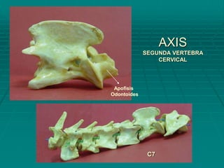 AXIS
SEGUNDA VERTEBRA
CERVICAL
C7
Apofisis
Odontoides
 