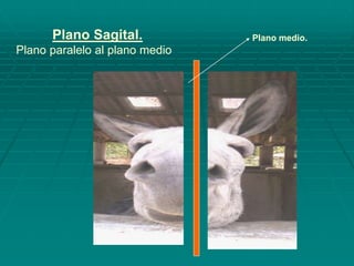 Plano Sagital.
Plano paralelo al plano medio
Plano medio.
 