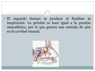 Anatomia de senos paranasales