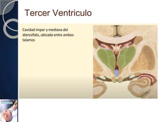 Tercer Ventriculo
 