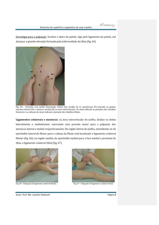 Anatomia de superfície e palpatória da coxa e joelho
Autor: Prof. Me. Leandro Nobeschi Página 8
Estratégia para a palpação: localize o ápice da patela, siga pelo ligamento da patela, até
alcançar a grande elevação formada pela tuberosidade da tíbia (fig. 64).
Fig. 64 – Paciente com joelho flexionado. Patela (A); tendão do m. quadríceps (F) inserido na patela;
menisco lateral (D) e menisco medial (E) na área interarticular. As setas indicam as posições dos côndilos
femorais e as cabeças de setas indicam a posição dos côndilos tibiais.
Ligamentos colaterais e meniscos: na área interarticular do joelho, deslize os dedos
lateralmente e medialmente, exercendo uma pressão maior para a palpação dos
meniscos lateral e medial respectivamente. Na região lateral do joelho, estendendo-se do
epicôndilo lateral do fêmur para a cabeça da fíbula está localizado o ligamento colateral
fibular (fig. 66); na região medial, do epicôndilo medial para a face medial e proximal da
tíbia, o ligamento colateral tibial (fig. 67).
Fig. 66 – Palpação do ligamento colateral fibular. Fig. 67 – Palpação do ligamento colateral tibial.
A
B
D E
F
 