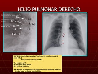 HILIO PULMONAR DERECHO tronco anterior lobar superior vena pulmonar superior derecha bronquiolo para el segmento anterior ...