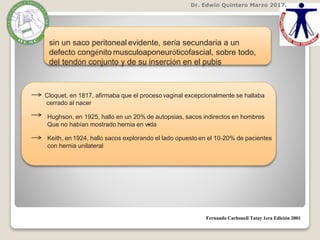 Dr. Edwin Quintero Marzo 2017.
Fernando Carbonell Tatay 1era Edición 2001
sin un saco peritoneal evidente, sería secundaria a un
defecto congénito musculoaponeuróticofascial, sobre todo,
del tendón conjunto y de su inserción en el pubis
-
Cloquet, en 1817, afirmaba que el proceso vaginal excepcionalmente se hallaba
cerrado al nacer
Hughson, en 1925, halló en un 20% de autopsias, sacos indirectos en hombres
Que no habían mostrado hernia en vida
Keith, en 1924, halló sacos explorando el lado opuesto en el 10-20% de pacientes
con hernia unilateral
 