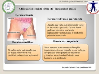 Dr. Edwin Quintero Marzo 2017.
Fernando Carbonell Tatay 1era Edición 2001
Clasificación según la forma de presentación clínica
Hernia primaria
Hernia recidivada o reproducida
Aquella que ya ha sido intervenida y que
se ha vuelto a producir. De esta forma,
podemos encontrar una hernia
reproducida y estrangulada o una hernia
primaria incarcerada.
Se define así a toda aquella que
se puede reintroducir con
facilidad en la cavidad abdominal
Hernia reductible Hernia estrangulada
Suele aparecer bruscamente en la región
inguinocrural, tras un pequeño o gran esfuerzo
que provoca una hiperpresión abdominal
y la salida a través del orificio del saco
herniario y su contenido.
 