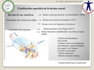 Dr. Edwin Quintero Marzo 2017.
Fernando Carbonell Tatay 1era Edición 2001
Clasificación específica de la hernia crural.
Bendavid las clasifica:
- Anomalías del orificio de salida:
- Anomalías del trayecto:
Hernia crural prevascular o de Hesselbach (1806)
Hernia retrovascular de Serafini (1917).
Hernias a través del ligamento de Gimbernat
Hernia pectínea o de Cloquet (1817).
Hernia bisacular o mulitlocular o de Astley Cooper
(1804)
3.Hernia de Hesselbach
Prevascular.
5.Hernia a traves del ligamento
de Gimbernat, también llamada
de Laugier o de Velpeau.
6.Hernia crural típica.
7.Hernia obturatriz.
8.Hernia Femoral externa.
3
8
7
6
5
 