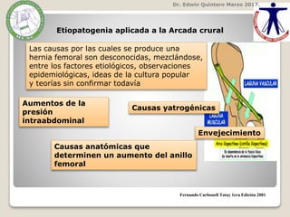 Dr. Edwin Quintero Marzo 2017.
Fernando Carbonell Tatay 1era Edición 2001
Etiopatogenia aplicada a la Arcada crural
Las causas por las cuales se produce una
hernia femoral son desconocidas, mezclándose,
entre los factores etiológicos, observaciones
epidemiológicas, ideas de la cultura popular
y teorías sin confirmar todavía
Aumentos de la
presión
intraabdominal
Causas yatrogénicas
Causas anatómicas que
determinen un aumento del anillo
femoral
Envejecimiento
 