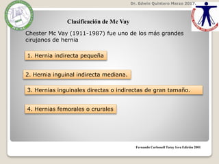 Dr. Edwin Quintero Marzo 2017.
Fernando Carbonell Tatay 1era Edición 2001
Clasificación de Mc Vay
Chester Mc Vay (1911-1987) fue uno de los más grandes
cirujanos de hernia
1. Hernia indirecta pequeña
2. Hernia inguinal indirecta mediana.
3. Hernias inguinales directas o indirectas de gran tamaño.
4. Hernias femorales o crurales
 
