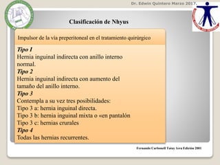 Dr. Edwin Quintero Marzo 2017.
Fernando Carbonell Tatay 1era Edición 2001
Clasificación de Nhyus
Impulsor de la vía preperitoneal en el tratamiento quirúrgico
Tipo I
Hernia inguinal indirecta con anillo interno
normal.
Tipo 2
Hernia inguinal indirecta con aumento del
tamaño del anillo interno.
Tipo 3
Contempla a su vez tres posibilidades:
Tipo 3 a: hernia inguinal directa.
Tipo 3 b: hernia inguinal mixta o «en pantalón
Tipo 3 c: hernias crurales
Tipo 4
Todas las hernias recurrentes.
 