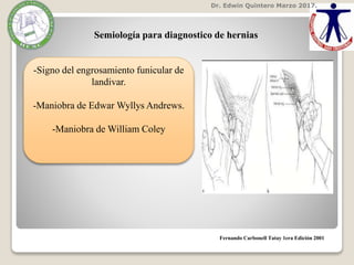 Dr. Edwin Quintero Marzo 2017.
Fernando Carbonell Tatay 1era Edición 2001
Semiología para diagnostico de hernias
-Signo del engrosamiento funicular de
landivar.
-Maniobra de Edwar Wyllys Andrews.
-Maniobra de William Coley
 
