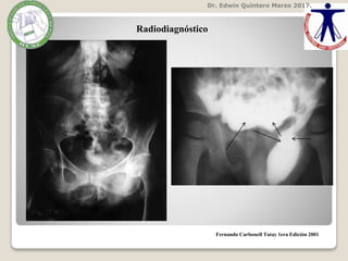 Dr. Edwin Quintero Marzo 2017.
Fernando Carbonell Tatay 1era Edición 2001
Radiodiagnóstico
 