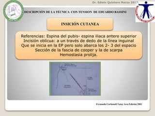 Dr. Edwin Quintero Marzo 2017.
Fernando Carbonell Tatay 1era Edición 2001
INSICIÓN CUTANEA
Referencias: Espina del pubis- espina iliaca antero superior
Incisión oblicua: a un través de dedo de la línea inguinal
Que se inicia en la EP pero solo abarca los 2- 3 del espacio
Sección de la fascia de cooper y la de scarpa
Hemostasia prolija.
DESCRIPCIÓN DE LA TÉCNICA CON TENSION DE EDUARDO BASSINI
 