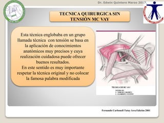 Dr. Edwin Quintero Marzo 2017.
Fernando Carbonell Tatay 1era Edición 2001
TECNICA QUIRURGICA SIN
TENSIÓN MC VAY
Esta técnica englobaba en un grupo
llamada técnica con tensión se basa en
la aplicación de conocimientos
anatómicos muy precisos y cuya
realización cuidadosa puede ofrecer
buenos resultados.
En este sentido es muy importante
respetar la técnica original y no colocar
la famosa palabra modificada
 