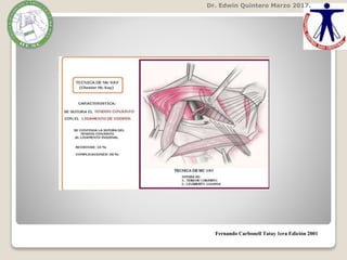 Dr. Edwin Quintero Marzo 2017.
Fernando Carbonell Tatay 1era Edición 2001
 