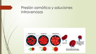 Presión osmótica y soluciones
intravenosas
 