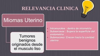 RELEVANCIA CLINICA
Miomas Uterino
Tumores
benignos
originados desde
el musculo liso
• Intramurales : dentro de miometrio
• Subserosos : Supera la superficie del
endometrio
• Submucoso: Crecen hacia la cavidad
uterina
 