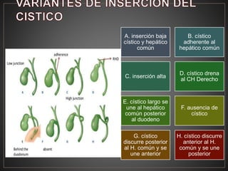 A. inserción baja
cístico y hepático
común
B. cístico
adherente al
hepático común
C. inserción alta
D. cístico drena
al CH Derecho
E. cístico largo se
une al hepático
común posterior
al duodeno
F. ausencia de
cístico
G. cístico
discurre posterior
al H. común y se
une anterior
H. cístico discurre
anterior al H.
común y se une
posterior
 