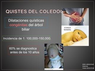 Dilataciones quísticas
congénitas del árbol
biliar
Incidencia de 1: 100,000-150,000.
60% se diagnostica
antes de los 10 años
dolor abdominal
Ictericia
masa abdominal
 