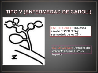 ENF. DE CAROLI: Dilatación
sacular CONGENITA y
segmentaria de los CBIH
SX. DE CAROLI: Dilatación del
conducto cístico+ Fibrosis
hepática.
 