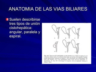 ANATOMIA DE LAS VIAS BILIARES Suelen describirse tres tipos de unión cistohepática: angular, paralela y espiral. 