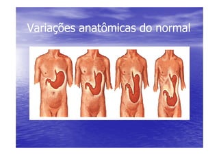 Variações anatômicas do normal
Variações anatômicas do normal
 