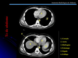 1. Coração 2. Aorta 3. Diafragma 4. Estomago 5. Fígado 6. Esôfago Tc de abdome Anatomia Radiológica do Abdome 