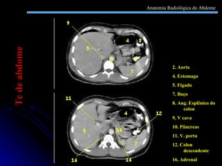 2. Aorta 4. Estomago 5. Fígado 7. Baço 8. Ang. Esplênico do colon 9. V cava 10. Pâncreas 11. V. porta 12. Colon descendente 16. Adrenal Tc de abdome Anatomia Radiológica do Abdome 