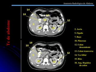 2. Aorta 5. Fígado 7. Baço 10. Pâncreas 12. Colon descendente 13. Colon transverso 14. Ves biliar 15. Rins 18. Ang. Hepático do colon Tc de abdome Anatomia Radiológica do Abdome 