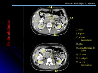 2. Aorta 5. Fígado 12. Colon descendente 15. Rins 18. Ang. Hepático do colon 19. V. renal 21. I. delgado 22. A. e V. mesentericas Tc de abdome Anatomia Radiológica do Abdome 