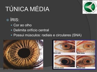 TÚNICA MÉDIA
 ÍRIS:
 Cor ao olho
 Delimita orifício central
 Possui músculos: radiais e circulares (SNA)
 