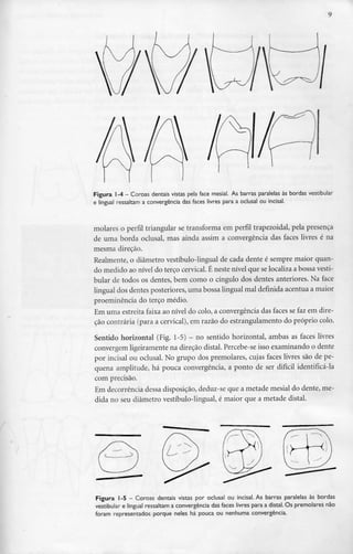 Figura 1-4 - Coroas dentais vistas pela face mesial. As barras paralelas às bordas vestibular
e lingual ressaltam a convergência das faces livres para a oclusal ou incisai.
molares o perfil triangular se transforma em perfil trapezoidal, pela presença
de uma borda oclusal, mas ainda assim a convergência das faces livres é na
mesma direção.
Realmente, o diâmetro vestíbulo-lingual de cada dente é sempre maior quan-
do medido ao nível do terço cervical. É neste nível que se localiza a bossa vesti-
bular de todos os dentes, bem como o cíngulo dos dentes anteriores. Na face
lingual dos dentes posteriores, uma bossa lingual mal definida acentua a maior
proeminência do terço médio.
Em uma estreita faixa ao nível do colo, a convergência das faces se faz em dire-
ção contrária (para a cervical), em razão do estrangulamento do próprio colo.
Sentido horizontal (Fig. 1-5) - no sentido horizontal, ambas as faces livres
convergem ligeiramente na direção distai. Percebe-se isso examinando o dente
por incisai ou oclusal. No grupo dos premolares, cujas faces livres são de pe-
quena amplitude, há pouca convergência, a ponto de ser difícil identificá-la
com precisão.
Em decorrência dessa disposição, deduz-se que a metade mesial do dente, me-
dida no seu diâmetro vestíbulo-lingual, é maior que a metade distai.
Figura 1-5 —Coroas dentais vistas por oclusal ou incisai. As barras paralelas às bordas
vestibular e lingual ressaltam a convergência das faces livres para a distai. Os premolares não
foram representados porque neles há pouca ou nenhuma convergência.
 
