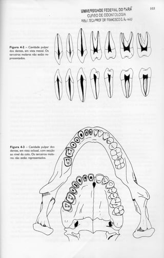 UHWEWADE FEDERAL DO^ARA
CURSO DE ODONTOLOGIA
DR FRANCISCO GA-AM
103
Figura 4-2 - Cavidade pulpar
dos dentes, em vista mesial. Os
terceiros molares não estão re-
presentados.
Figura 4-3 - Cavidade pulpar dos
dentes, em vista oclusal, com secção
ao nível do colo. Os terceiros mola-
res não estão representados.
 