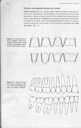 GENERALIDADES SOBRE OS DENTES
Direções convergentes das faces de contato
Sentido vertical (Fig.1-6) - as faces mesial e distai convergem em direção cer-
vical. Como consequência, o maior diâmetro mésio-distal está no terço incisai
ou oclusal e o menor, no terço cervical. Como os dentes de um mesmo arcose
tocam, numa relação de contiguidade, esse toque se dá pela maior proeminên-
cia mesial de um dente com a correspondente distai do vizinho (os incisivos
centrais se tocam por suas mesiais). O local de toque é conhecido como área
de contato* (Fig. 1-7).
Figura l-6 - Coroas dentais vis-
tas por vestibular. As barras pa-
ralelas às bordas mesial e distai
ressaltam a convergência das fa-
ces de contato para a cervical.
Figura l -7 —Áreas de contato
dos dentes de hemiarcos supe-
rior e inferior (distendidos) mar-
cadas com pequeno retângulo.
 