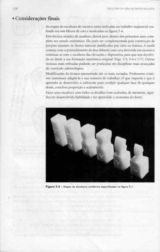 ESCULTURA EM CERA DE DENTES ISOLADOS
Considerações finais
As etapas da escultura do incisivo estão indicadas no trabalho sequencial rea-
lizado em seis blocos de cera e mostradas na figura 5-4.
Esta técnica simples de escultura dental para alunos dos primeiros anos com-
pleta seu estudo anatómico. Ela pode ser complementada pela construção de
porções ausentes de dentes naturais danificados por cárie ou fratura. A tarefa
começa com o preenchimento da área faltantecom cera derretida em excesso e
continua-se com a escultura das elevações e depressões, para que seja devolvi-
da ao dente a sua formação anatómica original (Figs. 5-5, 5-6 e 5-7). Outras
técnicas mais refinadas poderão ser praticadas em disciplinas mais avançadas
do currículo odontológico.
Modificações da técnica apresentada são as mais variadas. Professores criati-
vos costumam adaptá-la a sua maneira de trabalhar. O que importa é que o
aprendiz se desenvolva o suficiente para esculpir qualquer face de qualquer
dente, com boa proporção e acabamento.
Fazer uma escultura com todos os detalhes bem acabados, de memória, signi-
fica ter desenvolvido habilidade e ter aprendido a anatomia do dente.
Figura 5-4 - Etapas da escultura, conforme especificadas na figura 5-1.
 
