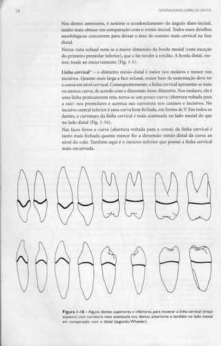 .- GENERALIDADES SOBRE OS DENTES
Nos dentes anteriores, é notório o arredondamento do ângulo disto-incisal,
muito mais obtuso em comparação com o mésio-incisal. Todos esses detalhes
morfológicos concorrem para deixar a área de contato mais cervical na face
distai.
Numa vista oclusal nota-se a maior dimensão da borda mesial (com exceção
do primeiro premolar inferior), que a faz tender à retidão. A borda distai, me-
nor, tende ao encurvamento (Fig. 1-5).
Linha cervical* - o diâmetro mésio-distal é maior nos molares e menor nos
incisivos. Quanto mais larga a face oclusal, maior base de sustentação deve ter
a coroa em nível cervical. Conseqúentemente, alinha cervicalapresenta-se mais
ou menos curva, de acordo com a dimensão desse diâmetro. Nos molares, elaé
uma linha praticamente reta, torna-se um pouco curva (abertura voltada para
a raiz) nos premolares e acentua sua curvatura nos caninos e incisivos. No
incisivo central inferior é uma curva bem fechada,em forma de V.Em todos os
dentes, a curvatura da linha cervical é mais acentuada no lado mesial do que
no lado distai (Fig. 1-16).
Nas faces livres a curva (abertura voltada para a coroa) da linha cervical é
tanto mais fechada quanto menor for a dimensão mésio-distal da coroa ao
nível do colo. Também aqui é o incisivo inferior que possui a linha cervical
mais encurvada.
Figura 1-16 -Alguns dentes superiores e inferiores,para mostrar a linha cervical (traço
espesso) com curvatura mais acentuada nos dentes anteriores e também no lado mesial
em comparação com o distai (segundo Wheeler).
 