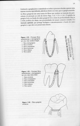 19
Limitando a gengivalivre e estendendo-se sobre o processo alveolar, aparece uma
espessa mucosa especializada,aderida ao dente eao osso, que é a gengiva inserida.
As fibras gengivais são uma trama de fibras que ajudam na inserção do peri-
odonto de proteção ao colo do dente (Figs. 1-22, 1-23 e 1-24). O epitélio da
gengiva livre, no fundo do sulco gengival (0,5 a 2mm de profundidade) fixa-se
a toda periferia do dente, nas proximidades da junção cemento-esmalte. É a
inserção epitelial, que protege biológica e mecanicamente o fundo do sulco
gengival, e que deve ser preservada intacta.
Figura 1-22 - Principais fibras
alveolodentais e dentogengivais
em uma vista vestíbulo-lingual.
1 Fibras dentogengivais
2 Fibras circulares
3 Fibras crestodentais
4 Fibras horizontais
5 Fibras oblíquas
6 Fibras apicais
Figura 1-23 - Principais fibras
alveolodentais e dentogengivais
em uma vista mésio-distal.
Fibras circulares
Fibrastransgengivais
Fibrastransseptais
4 Fibras horizontais
5 Fibras oblíquas
6 Fibras apicais
Figura 1-24 - Fibras gengivais
circulares.
 