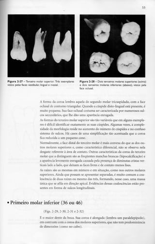 53
Figura 2-27 -Terceiro molar superior. Três exemplares
vistos pelas faces vestibular, lingual e mesial.
Figura 2-28 - Dois terceiros molares superiores (acima)
e dois terceiros molares inferiores (abaixo), vistos pela
face oclusal.
A forma da coroa lembra aquela do segundo molar tricaspidado, com a face
oclusal de contorno triangular. Quando a cúspide disto-lingual está presente, é
muito pequena. Sua face oclusal costuma ser caracterizada por numerosossul-
cos secundários, que lhe dão uma aparência enrugada.
As formas do terceiro molar superior são tão variáveis que em alguns exempla-
res é difícil identificar exatamente as suas cúspides. Algumas vezes, a comple-
xidade da morfologia reside no aumento do número de cúspides e no confuso
sistema de sulcos. Há casos de uma simplificação tão acentuada que a coroa
fica reduzida a um pequeno cone.
Normalmente, a face distai do terceiro molar é mais convexa do que as dos ou^
tros molares superiores e, como característica diferencial, não se observa nela
desgaste referente à área de contato. Outras características da coroa do terceiro
molar que a distinguem são as frequentes manchas brancas (hipocalcificação) e
a aparência levemente enrugada causada pela presença de diminutas cristas ver-
ticais lado a lado, que deixam as faces livres e de contato menos lisas.
As raízes são as mesmas em número e em situação, como nos outros molares
superiores. Ainda que possam se apresentar separadas, é muito comum acoa-
lescência de duas raízes ou mesmo das três, formando, nesse caso, uma massa
única que se afila em direção apical. Evidências dessas coalescências estãopre-
sentes em forma de sulcos longitudinais.
Primeiro molar inferior (36 ou 46)
(Figs. 2-29, 2-30, 2-31e 2-32)
É o maior dente da boca. Sua coroa é alongada (lembra um paralelepípedo),
em contraste com a coroa dos molares superiores, que não tem predominância
de dimensões (como no cubo).
 